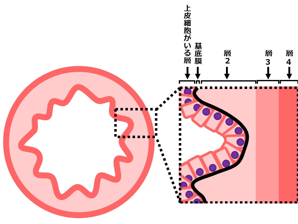 腸の断面図