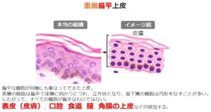 「上皮」とは?生物学、病理学でよく聞く「上皮」。誰にでも分かりやすく画像を使って解説! どっと. New life
