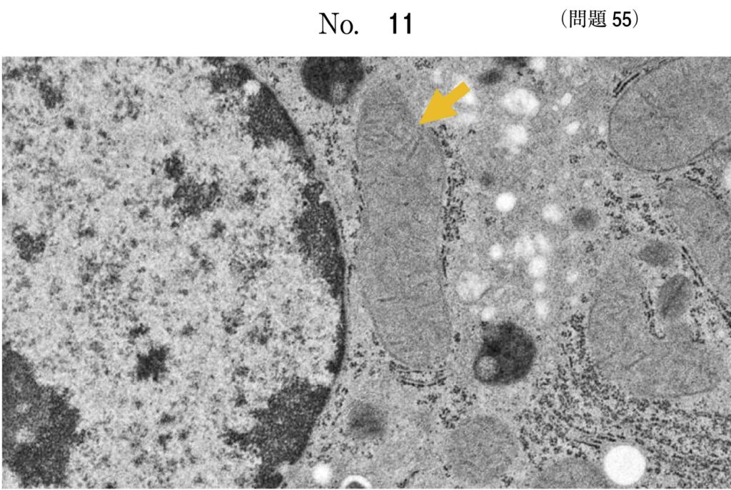 ミトコンドリの電子顕微鏡国家試験問題