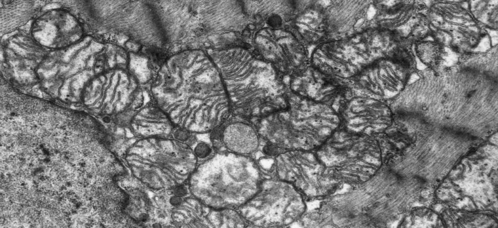 ミトコンドリアの電子顕微鏡写真