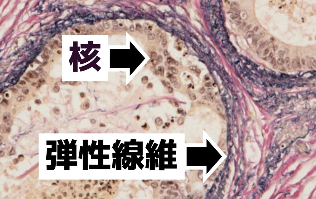 EVG染色の弾性線維と角の色