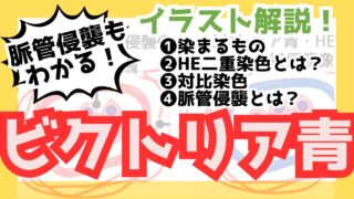 【ビクトリア青染色】ビクトリア青染色の画像問題は血管侵襲が9割！見分け方を徹底解説