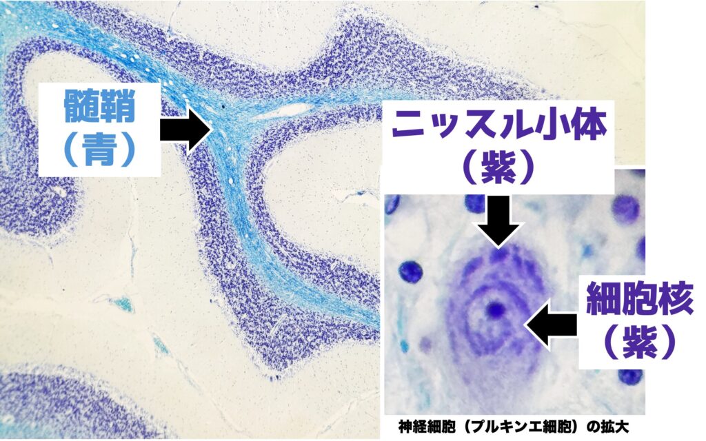 クリューバー・バレラ染色の組織像 髄鞘は青、ニッスル小体と細胞核は紫に染まっている