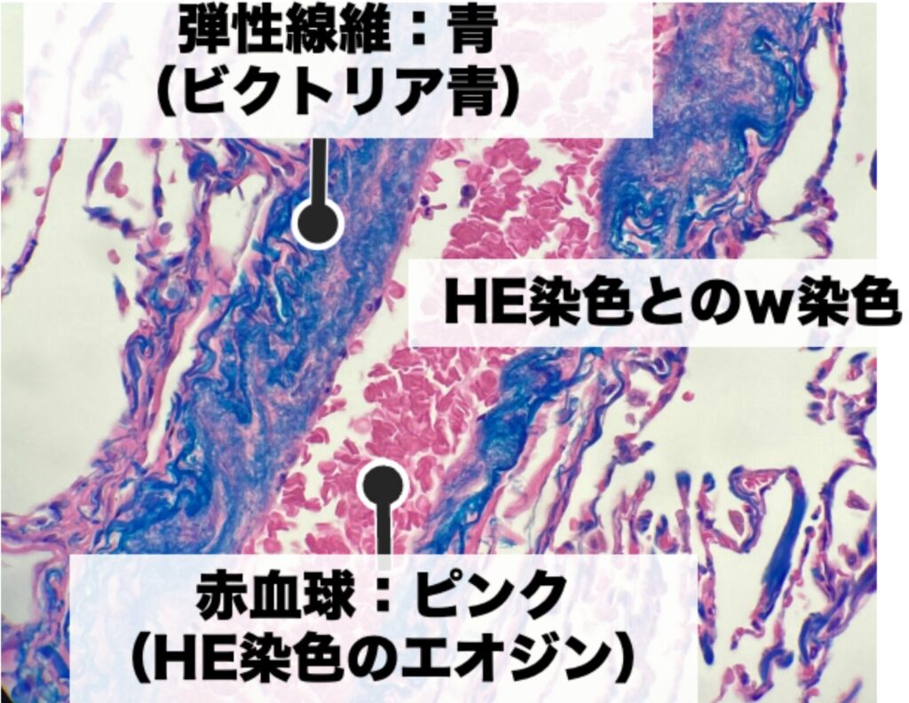 ビクトリア青染色
弾性線維が青く染まっている