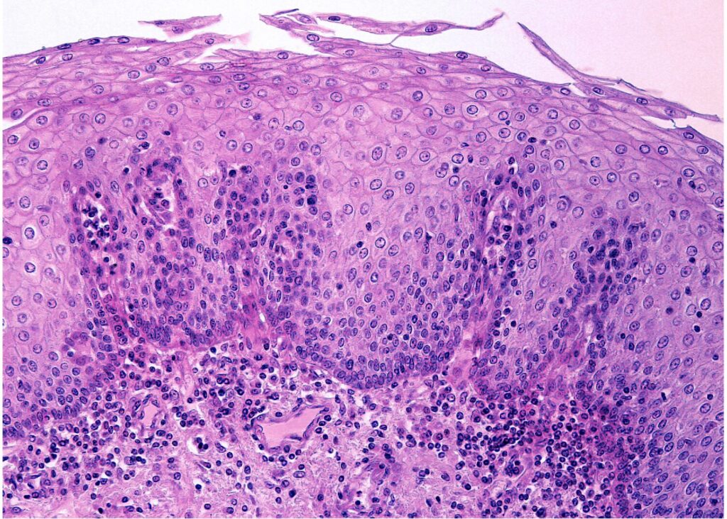 食道の上皮|非角化型重層扁平上皮