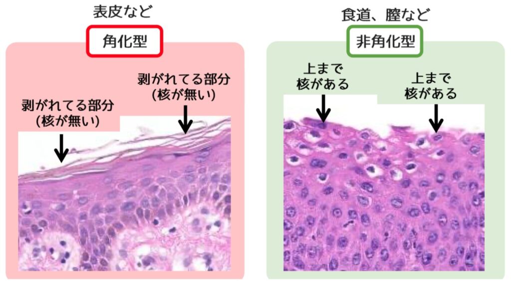 角化と非角化の違い