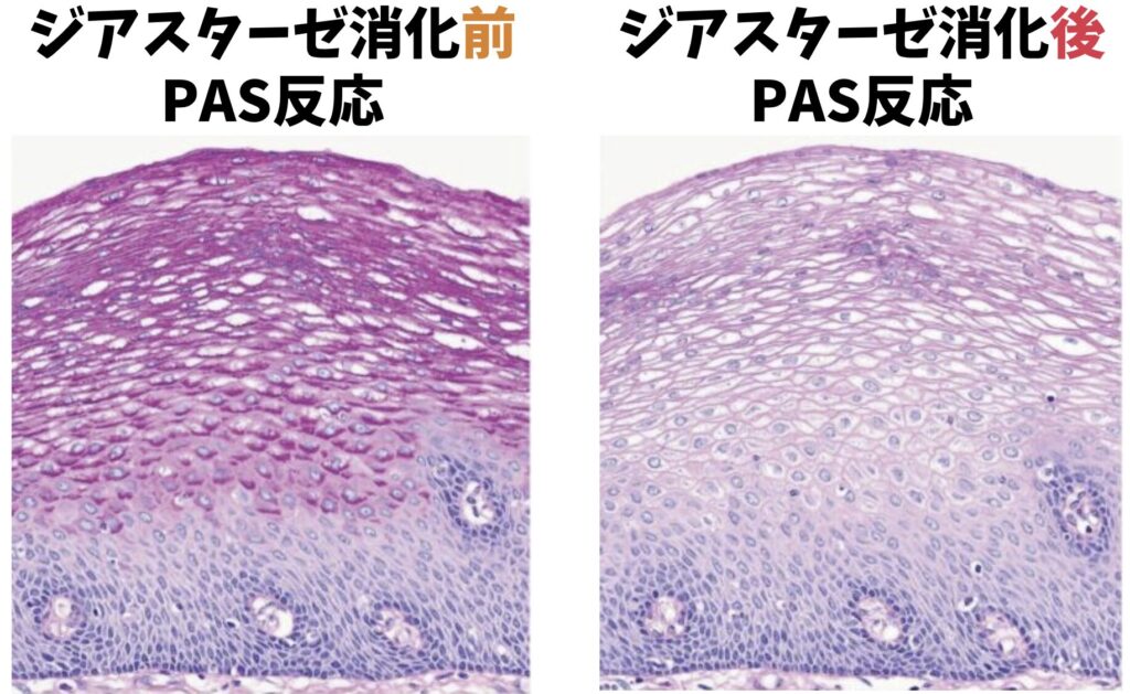 左:食道上皮のグコーゲンがPAS反応+
右:グリコーゲンが消化されてPASー
