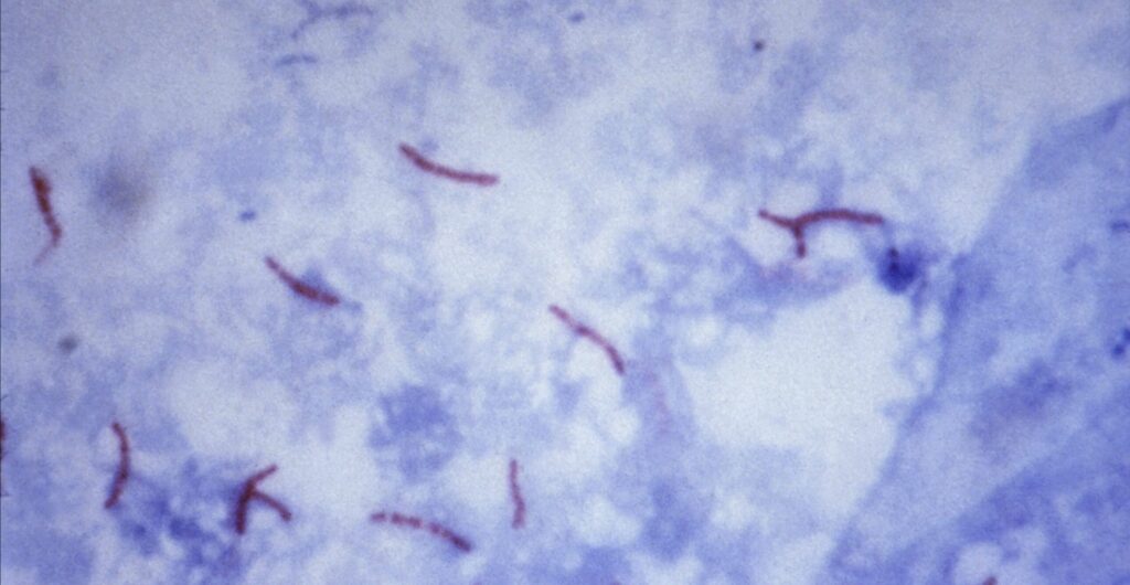 チールネルゼン染色の画像 抗酸菌が赤、背景メチレン青