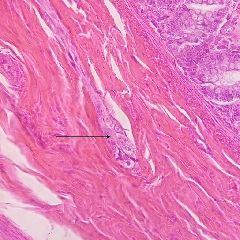 マイスナーの粘膜下神経叢
Submucous plexus (Meissner's plexus).jpg" by Leonardo M. Lustosa is licensed under CC BY-SA 4.0