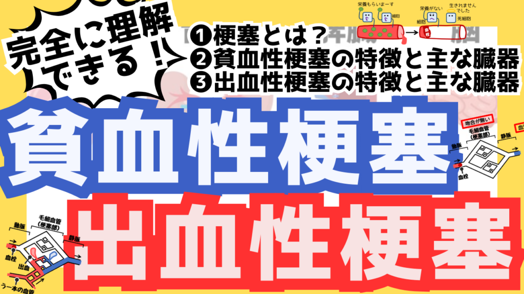 貧血性梗塞と出血性梗塞
