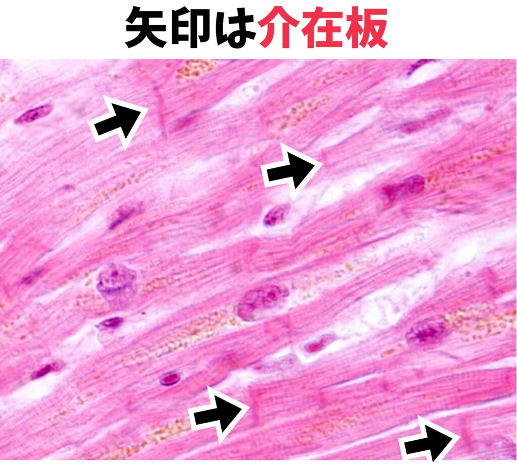 心筋の介在板