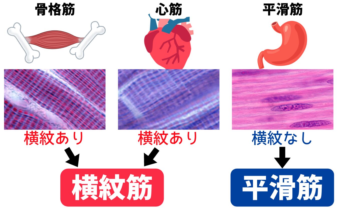 筋輝度 読み方 _ 筋輝度 超音波画像 | muscleの発音記号と読み方 – MXTY