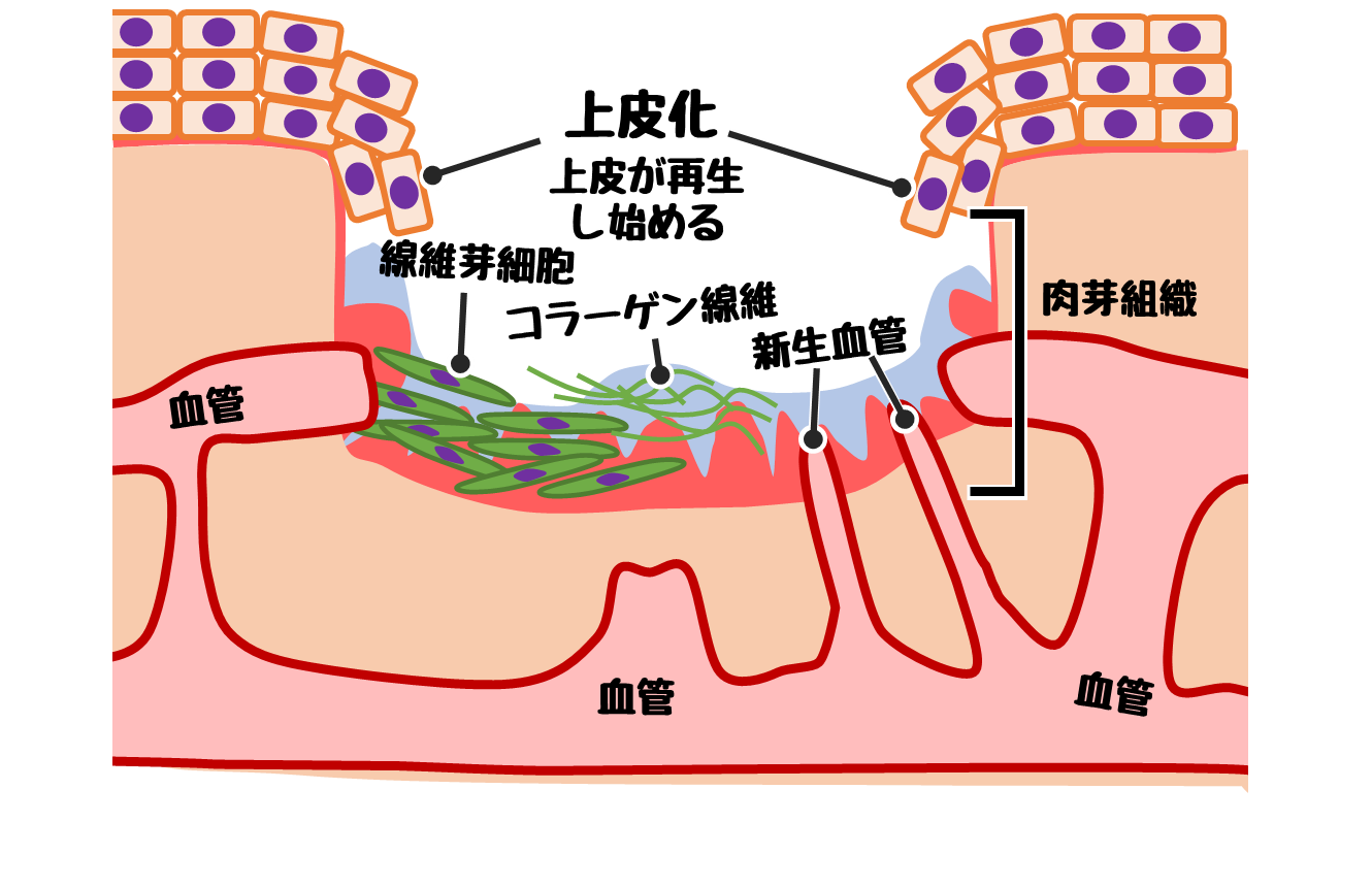 退行性病変とは わかりやすく _ 退行性病変 変性とは _ ≪病理学 退行性変化≫ 専門学校の授業ようですが。。。 – YZJX