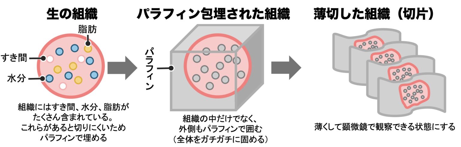 【包埋】手順・方法・試薬のポイントをイラスト解説！パラフィン包埋を中心に