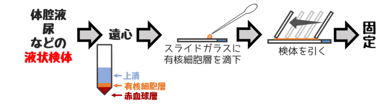 国試のための 細胞診 知識を全てまとめました｜どっと. New life