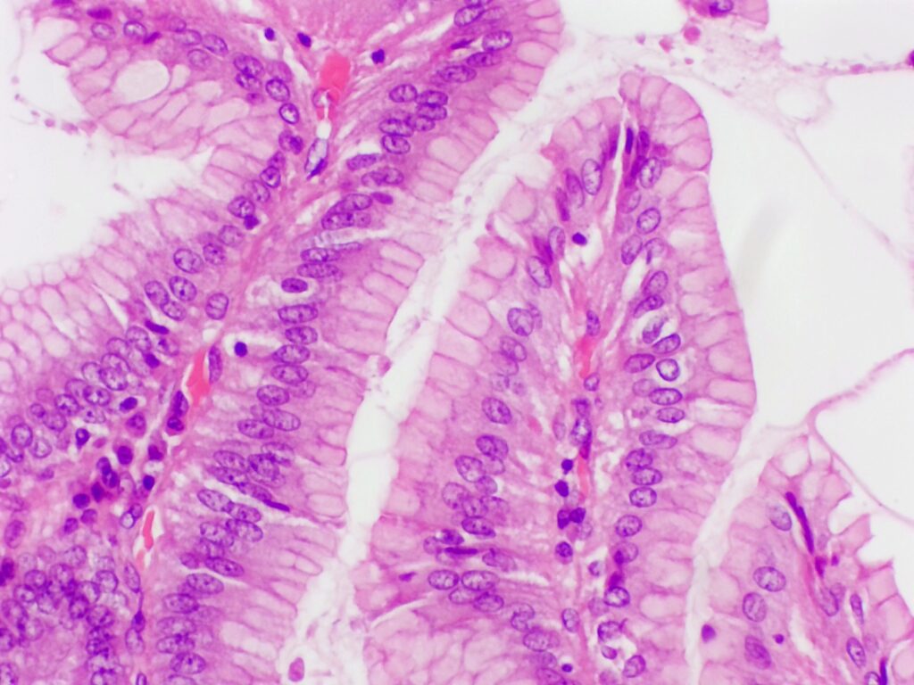 表層と胃小窩に粘液を大量に含む表層粘液細胞が見られる