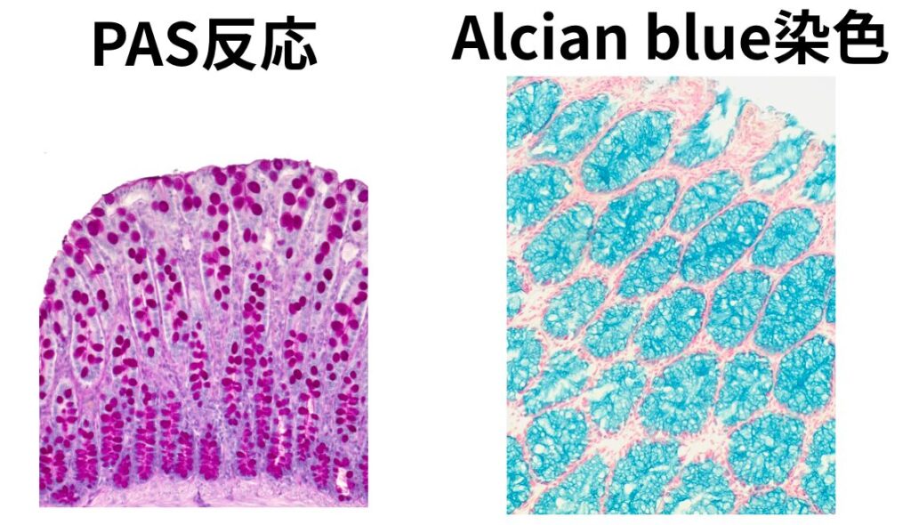 大腸杯細胞の特殊染色像比較。PAS反応では赤紫色（マゼンタ）、アルシアンブルー染色では青色に陽性を示し、細胞質に粘液が充満していることがわかる