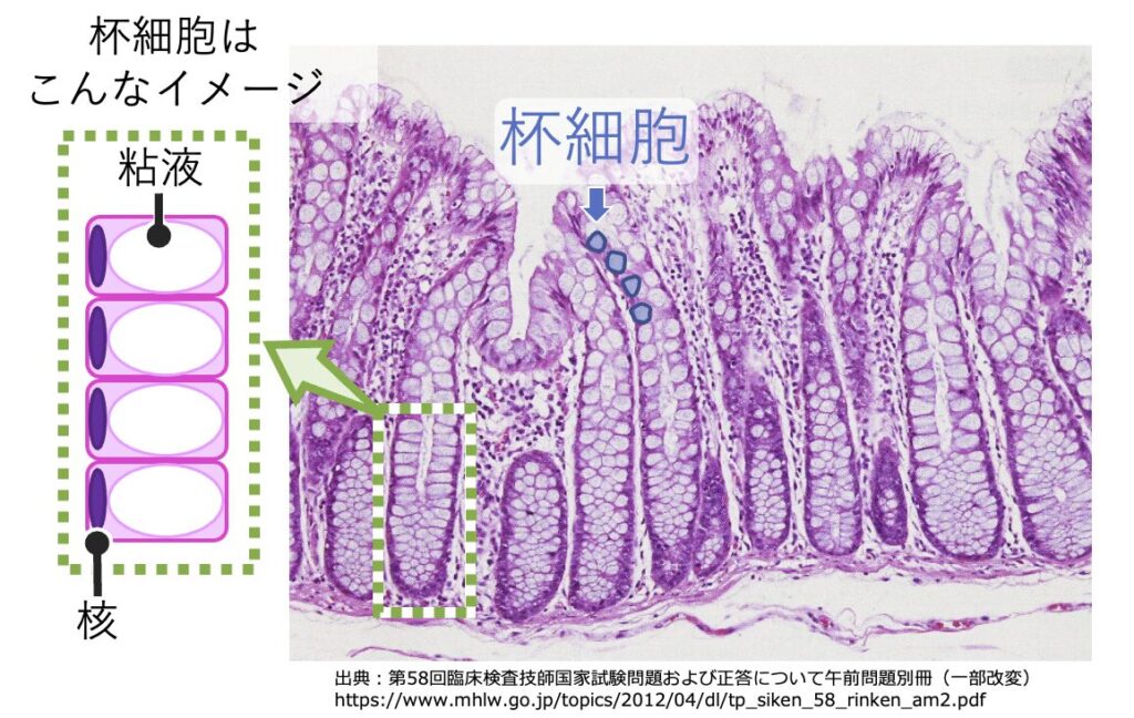 大腸上皮の杯細胞（Goblet cell）の顕微鏡写真と模式図。HE染色像では粘液部分が白く抜け、イラストでは粘液によって核が基底側に圧排されている特徴的な構造が示されている。臨床検査技師国家試験画像を使用。