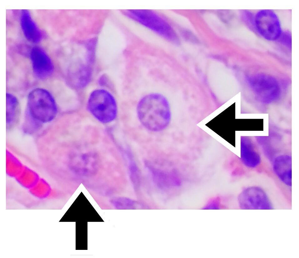 胃底腺の壁細胞(HE染色像)。ミトコンドリアが豊富なためエオジン好性(赤色)を示す。