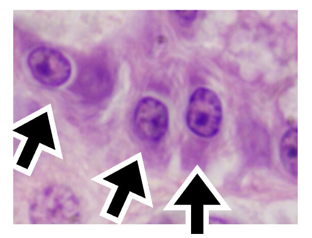 主細胞のHE染色像
核小体が目立つヘマトキシリン好性の主細胞が3つ見える