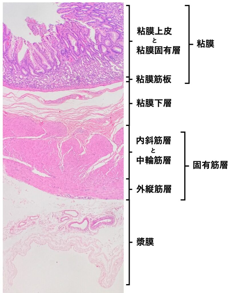 胃壁の層構造(粘膜、粘膜下層、筋層、漿膜)を示す組織標本(HE染色)