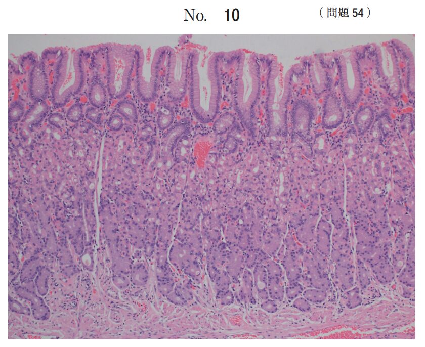 出典:第70回臨床検査技師国家試験問題および正答について
午後問題別冊