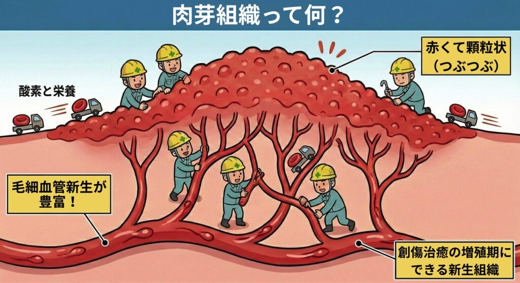 「2. 肉芽組織には毛細血管が乏しい。」という誤った認識を正す解説画像。テキストでは、肉芽組織は創傷治癒の増殖期にできる新生組織であり、毛細血管新生が豊富で赤く顆粒状に見えるのが特徴と説明されている。また、ケロイドと違って柔らかく、毛細血管が乏しいのは成熟した瘢痕組織であると述べられている。下のイラストには「肉芽組織って何?」というタイトルがあり、赤い顆粒状の組織の断面が描かれている。下部の太い血管から多数の毛細血管が新生し、網目状に広がっている様子が「毛細血管新生が豊富!」というラベルとともに示されている。ヘルメットをかぶった作業員が血管を構築し、トラックが「酸素と栄養」を運んでおり、組織の表面は「赤くて顆粒状(つぶつぶ)」と説明されている。右下には「創傷治癒の増殖期にできる新生組織」という説明書きがある。
