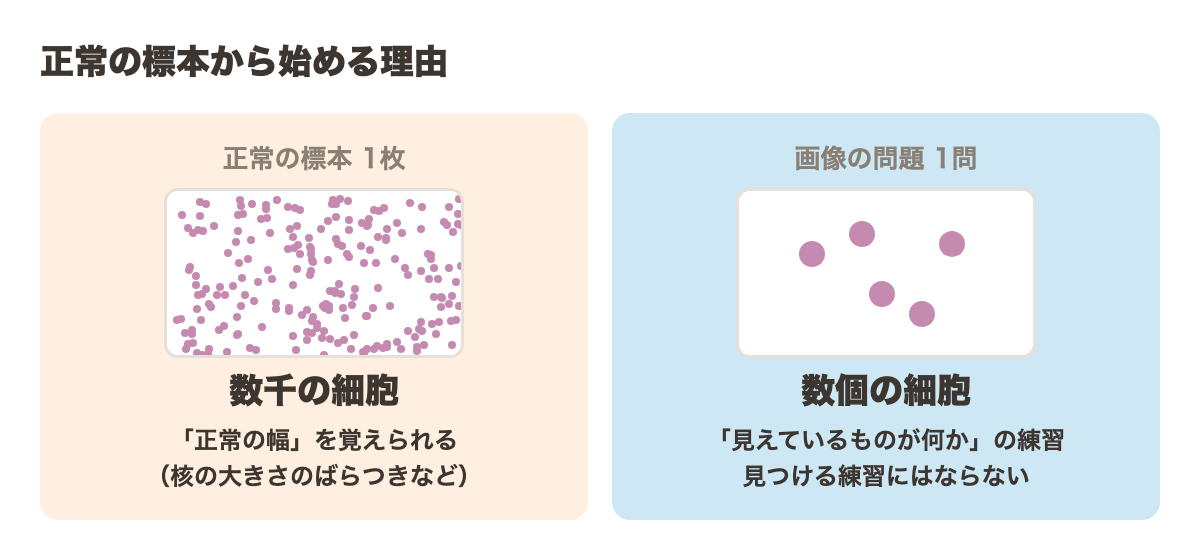 正常の標本から始める理由。正常の標本1枚には数千の細胞があり正常の幅を覚えられる。画像の問題1問は数個の細胞で、見えているものが何かの練習になるが見つける練習にはならない
